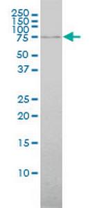 ABCF2 Antibody in Western Blot (WB)