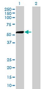 RNUT1 Antibody in Western Blot (WB)