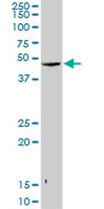 SNUPN Antibody in Western Blot (WB)