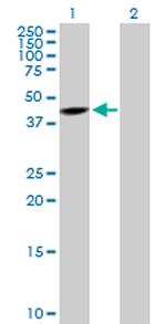 SNUPN Antibody in Western Blot (WB)