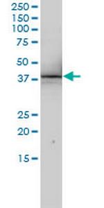 RNUT1 Antibody in Western Blot (WB)