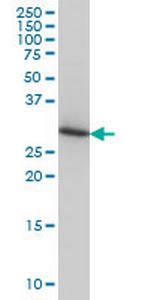 ARPC2 Antibody in Western Blot (WB)