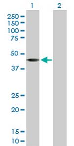 SGK2 Antibody in Western Blot (WB)