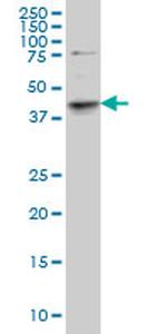 SGK2 Antibody in Western Blot (WB)