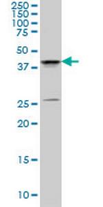 SGK2 Antibody in Western Blot (WB)