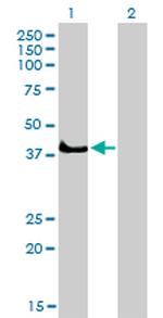 SGK2 Antibody in Western Blot (WB)