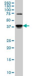 SGK2 Antibody in Western Blot (WB)