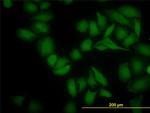 SGK2 Antibody in Immunocytochemistry (ICC/IF)