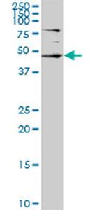 SGK2 Antibody in Western Blot (WB)