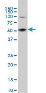 SGK2 Antibody in Western Blot (WB)