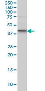 SGK2 Antibody in Western Blot (WB)