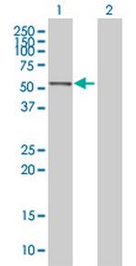 ACTR1A Antibody in Western Blot (WB)