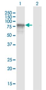 OPTN Antibody in Western Blot (WB)