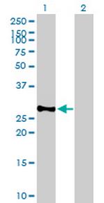 BCAP31 Antibody in Western Blot (WB)