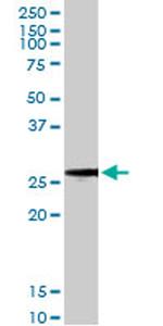 BCAP31 Antibody in Western Blot (WB)