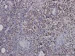 G3BP1 Antibody in Immunohistochemistry (Paraffin) (IHC (P))