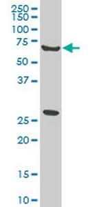 WASF2 Antibody in Western Blot (WB)