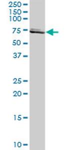 SLC25A13 Antibody in Western Blot (WB)