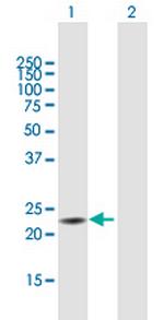 TXNDC9 Antibody in Western Blot (WB)