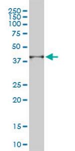 PSMD14 Antibody in Western Blot (WB)