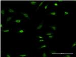 OLIG2 Antibody in Immunocytochemistry (ICC/IF)