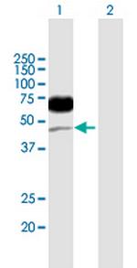 CD96 Antibody in Western Blot (WB)