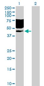 CD96 Antibody in Western Blot (WB)