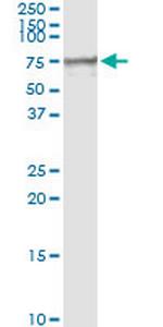 MSLN Antibody in Immunoprecipitation (IP)