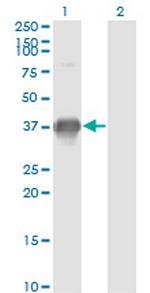 SPRY1 Antibody in Western Blot (WB)