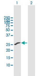 IGSF6 Antibody in Western Blot (WB)