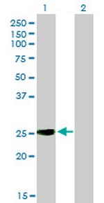 IGSF6 Antibody in Western Blot (WB)