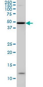 IRX5 Antibody in Western Blot (WB)