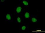 SDCCAG10 Antibody in Immunocytochemistry (ICC/IF)