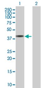 SDCCAG10 Antibody in Western Blot (WB)