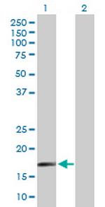 SAP18 Antibody in Western Blot (WB)