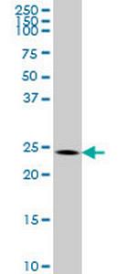 BCAS2 Antibody in Western Blot (WB)