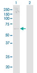 TCIRG1 Antibody in Western Blot (WB)