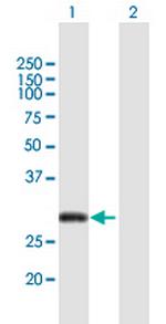 CITED2 Antibody in Western Blot (WB)