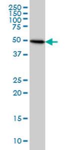 TUBB4B Antibody in Western Blot (WB)