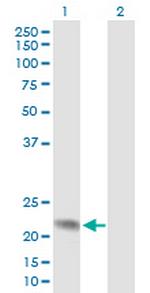 ANAPC10 Antibody in Western Blot (WB)