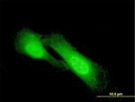 NDRG1 Antibody in Immunocytochemistry (ICC/IF)