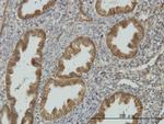 NDRG1 Antibody in Immunohistochemistry (Paraffin) (IHC (P))