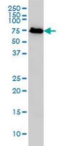 KNTC2 Antibody in Western Blot (WB)