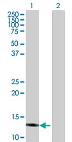 IFITM3 Antibody in Western Blot (WB)