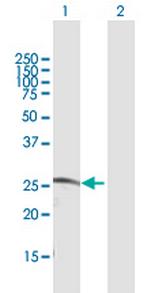 CDC42EP2 Antibody in Western Blot (WB)