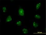 C1D Antibody in Immunocytochemistry (ICC/IF)