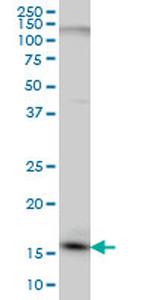 C1D Antibody in Western Blot (WB)