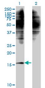 C1D Antibody in Western Blot (WB)