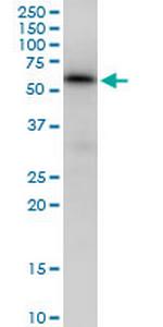 MAP3K7IP1 Antibody in Western Blot (WB)