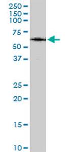 MAP3K7IP1 Antibody in Western Blot (WB)